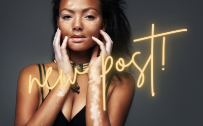 Brow Lamination and Vitiligo