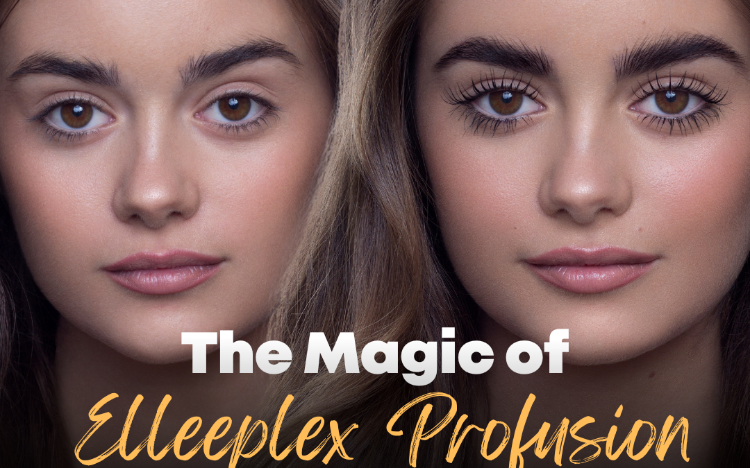 The Magic of Elleeplex Profusion